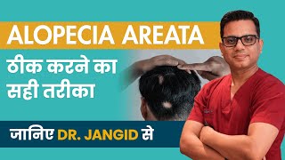 Alopecia Areata Treatment Process 2024  Patchy Hair Loss Diagnosis  By Dr Jangid  SkinQure [upl. by Panthia964]