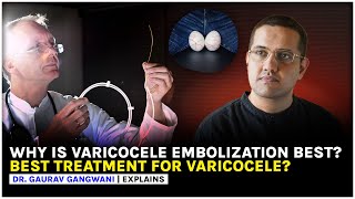 Varicocele  Nonsurgical treatment of Varicocele  Varicocele embolization  Dr Gaurav Gangwani [upl. by Crooks]