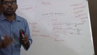 PATHOPHYSIOLOGY OF ASCITES [upl. by Tamarra398]