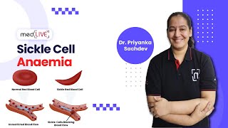 Sickle Cell Anaemia  Pathogenesis  Factors  Diagnosis by DR Priyanka Sachdev  MedLive [upl. by Rogerg]