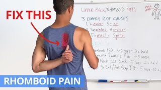 How to Fix Upper Back  Rhomboid Pain for GOOD 4 Effective Exercises [upl. by Areit814]