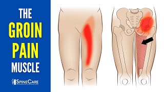 The Groin Pain Muscle How to Release It for INSTANT RELIEF [upl. by Rockel]