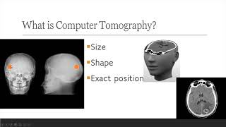 தமிழில்  What is Computer Tomography  what is computer tomography in Tamil [upl. by Lynsey]