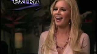 Heidi Montag  Plastic Surgery Procedures [upl. by Tove994]