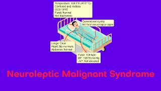 Neuroleptic Malignant Syndrome  NMS  Hyperpyrexia syndromes [upl. by Ola]