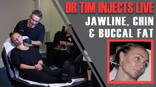 FULL JAWLINE TREATMENT Dr Tim Injects Jawline Chin amp Buccal Fat Live Aesthetics Mastery Show [upl. by Kellyn]