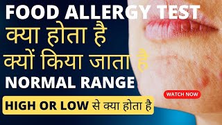 Food allergy test kaise hota hai  food allergy testing in Hindi  Allergy test kaise hota hai [upl. by Morrissey]