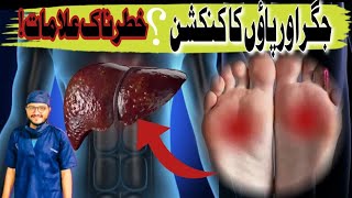 Liver disease and foot connection some alarming sign and symptomsDr H Muhammad Anees [upl. by Sawtelle586]