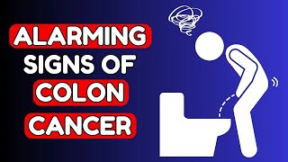 8 Warning Signs of COLON CANCER you Shouldnt Ignore  Nourish Hub [upl. by Utham]