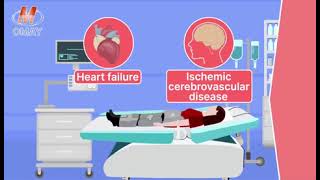 EECPa noninvasive and US FDA approved treatment for ischemic heart diseases [upl. by Kcerb]