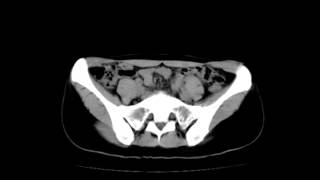 私のレントゲン写真 割れ目が！！！ X‐ray 違法なものではりません [upl. by Fonzie]