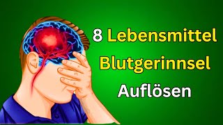 Die 8 besten Lebensmittel zur natürlichen Auflösung von Blutgerinnseln Gesunde Ernährungstipps [upl. by Raynah]