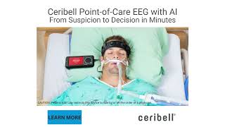 Ceribell PointofCare EEG with AI [upl. by Adni]