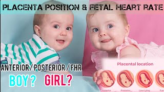 PLACENTA POSITION AND FHR VS BABY GENDER anterior placenta posteriorplacenta boybaby girlbaby [upl. by Quill]