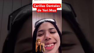 Carillas dentales de Yeri Mua shorts carillasdentales yerimua odontologia odontologiaestetica [upl. by Ainirtak]