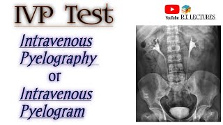 IVP testIntravenous Pyelography IVUIntravenous Urographytest Excretoru Urography test complte [upl. by Anama]