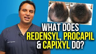 Redensyl Procapil and Capixyl For Hair Growth [upl. by Eulau515]