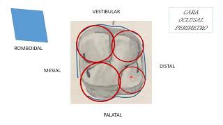 1er Molar Superior [upl. by Chickie]