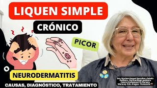 LIQUEN SIMPLE CRÓNICO o NEURODERMATITIS La piel pica se engrosa y mancha ​⁠depielapiel [upl. by Ab829]