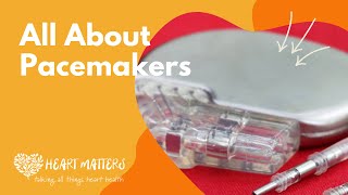 What you should know about pacemakers [upl. by Alakcim]