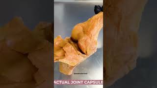 Knee joint education jointmovement support medicalscience healthytips [upl. by Gwyneth]