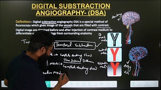 DSA  DIGITAL SUBTRACTION ANGIOGRAPHY  PRINCIPLE PART1 TYPE OF DSA  IN HINDI  MADE EASY [upl. by Alten]