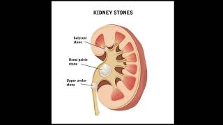 Acute Kidney Injury Ciwon Ƙoda 2 [upl. by Balfour]