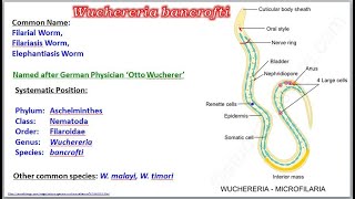 Wuchereria Filarial Worm [upl. by Lerad]