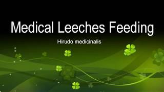 Medical Leeches Feeding  Hirudo medicinalis [upl. by Leland]