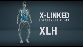 Xlinked hypophosphatemia XLH mechanism of disease [upl. by Dreyer535]