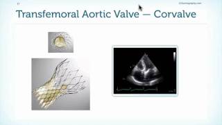 Assessment of Prostheses in Echocardiography [upl. by Atikahc284]