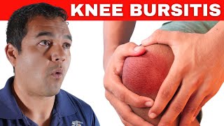 Healing Knee Bursitis Top 5 Treatments for Rapid Healing [upl. by Charlene]