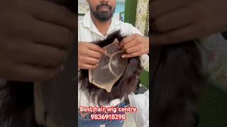 Best hair wigs shop in Kolkata Best hair patch centre for men’s Baldness solvehaircarespecialist [upl. by Guendolen126]