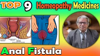 Anal Fistula Causes Symptoms and homeopathy Treatment  Dr P S Tiwari [upl. by Dominic]