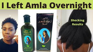 I Used Amla Oil On My Natural Hair Overnight and I Got Shocking Results [upl. by Philipines]