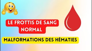 Le frottis de sang normal et Malformations des hématies [upl. by Monte]