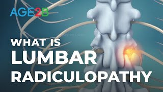 What Is Lumbar Radiculopathy  Lumbar Nerve Roots  Disc Bulge [upl. by Ydneh131]