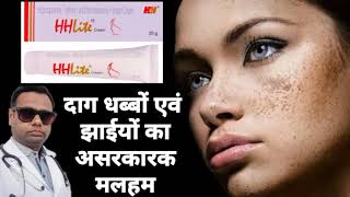 Ointment for melasma। HH lite ointment review Hydroquinone Tretinoin amp Mometasone cream। uses। [upl. by Yeargain955]