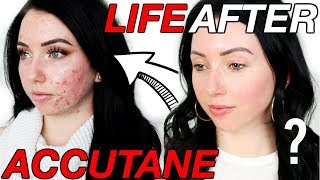 Was it Worth it 6 Months POSTACCUTANE  Lasting Side Effects Scarring Breakouts Coming Back [upl. by Jorgenson]