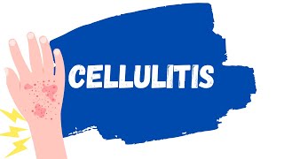 Cellulitis Skin Infection  Treatment erysipelas [upl. by Anaugal89]