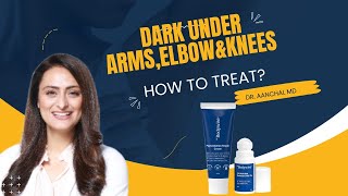 Dark underarms elbows and knees  How to treat  Dermatologist recommends  Be Bodywise Review [upl. by Fantasia593]