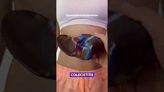 🥼Patologías y DOLOR ABDOMINAL🩺 [upl. by Nylodnewg]