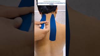 Kinesiology Tapping for cervical spondylitis physicaltherapy doctor yt kinesiology taping [upl. by Nahej845]