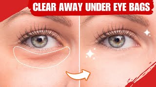 How to Get Rid of Under EYE BAGS Get Instant Results [upl. by Ennaitak961]