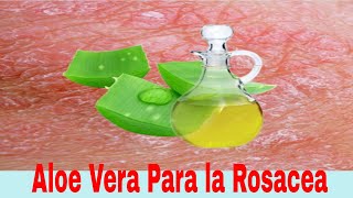 Qué tan Efectivo es el Aloe Vera Para la Rosácea [upl. by Janerich]