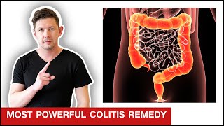 How To QUICKLY Stop Colitis amp Ulcerative Colitis [upl. by Lladnar]