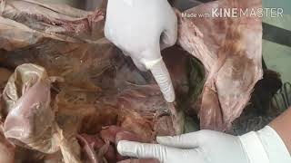 Dissection of Peritoneal Cavity by DrMeetu Agarwal [upl. by Leshia220]