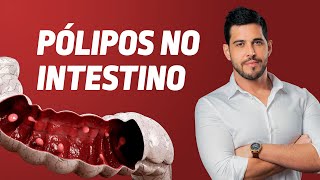 APARECEU UM PÓLIPO NA COLONOSCOPIA [upl. by Palermo]