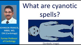 What are cyanotic spells [upl. by Rebe]