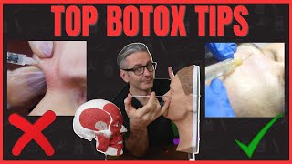 Top 6 Botox Injection Tips [upl. by Imit]